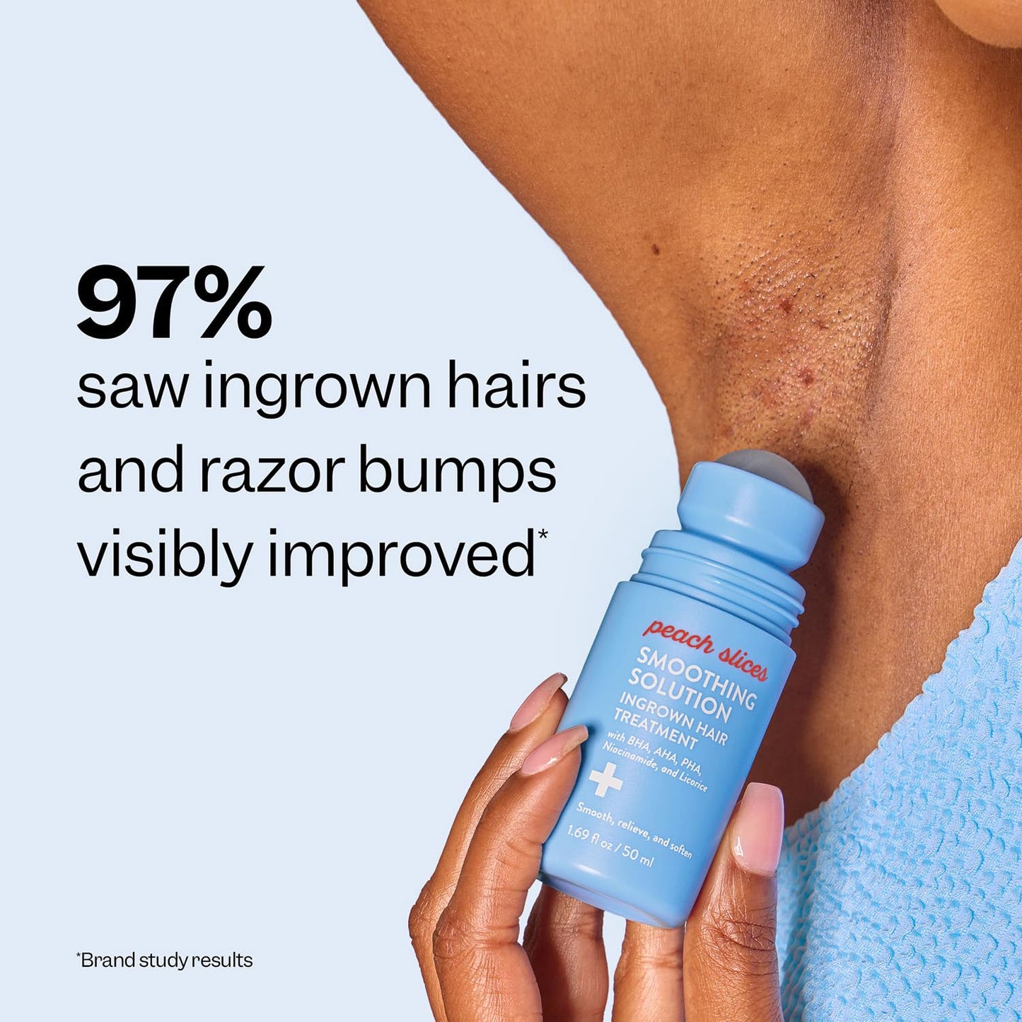 Vovexa™ Smoothing Solution for Ingrown Hair