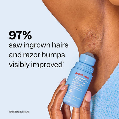 Vovexa™ Smoothing Solution for Ingrown Hair
